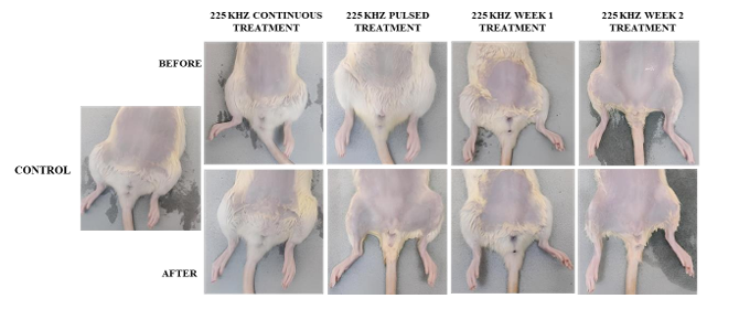 RF magnetic heating clinical study information